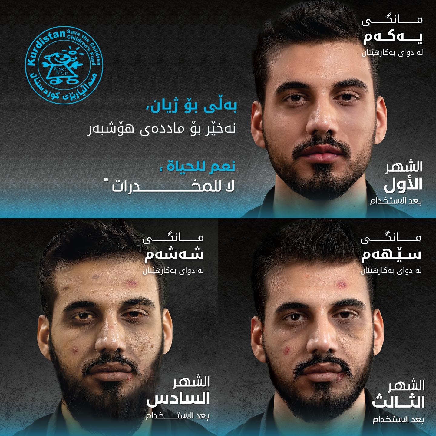 هەرێمی کوردستانی عێراق: ڕێکخراوی منداڵپارێزی کوردستان کاردەکات بۆ بڵاوکردنەوەی هەڵمەتی "بەڵێ بۆ ژیان، نەخێر بۆ ماددەی هۆشبەر" لەسەرانسەری عێراق